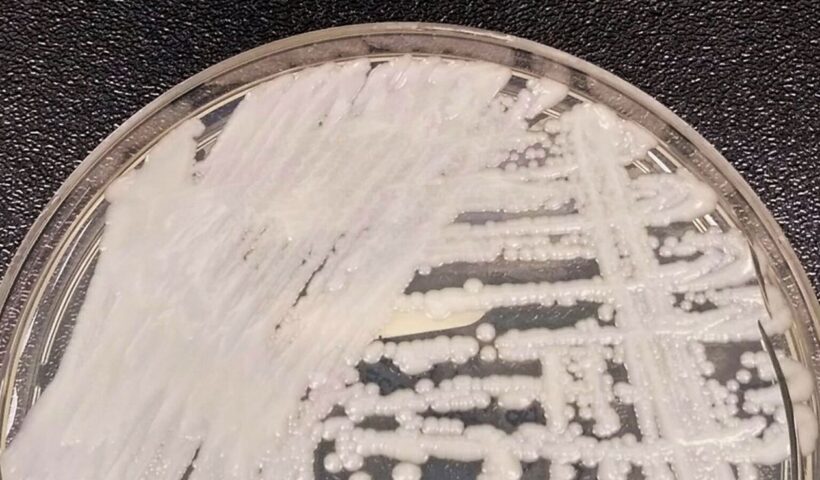 Anvisa confirma novo caso do superfungo Candida auris
