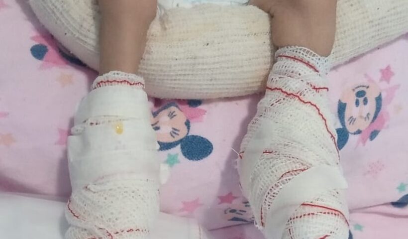 Coren-SP investigará conduta de enfermeiros após bebê sofrer queimaduras em Jacareí